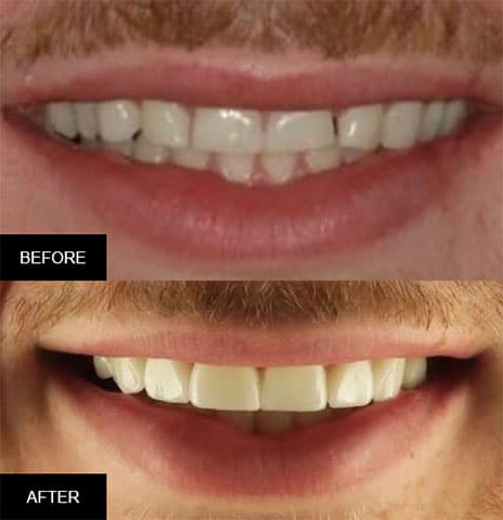 @ET-DC@eyJkeW5hbWljIjp0cnVlLCJjb250ZW50IjoicG9zdF90aXRsZSIsInNldHRpbmdzIjp7ImJlZm9yZSI6IiIsImFmdGVyIjoiIn19@